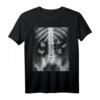 Egirl Skeleton Xray Butterfly Harajuku T-Shirt – Dunkles Y2K, Grunge & Gothic Style für Halloween, Punkrock & Emo Fans